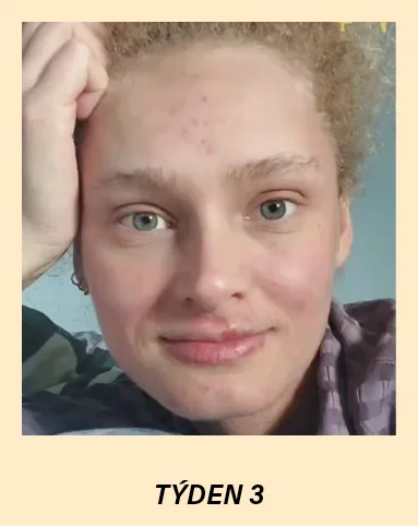 new