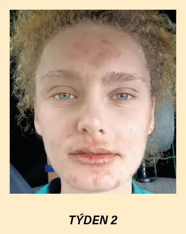 new