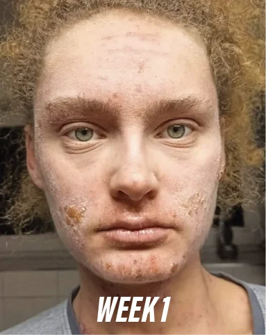 new