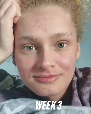 new