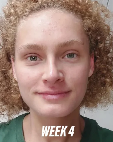 new