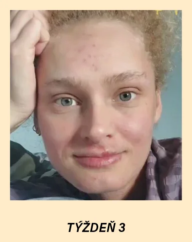 new