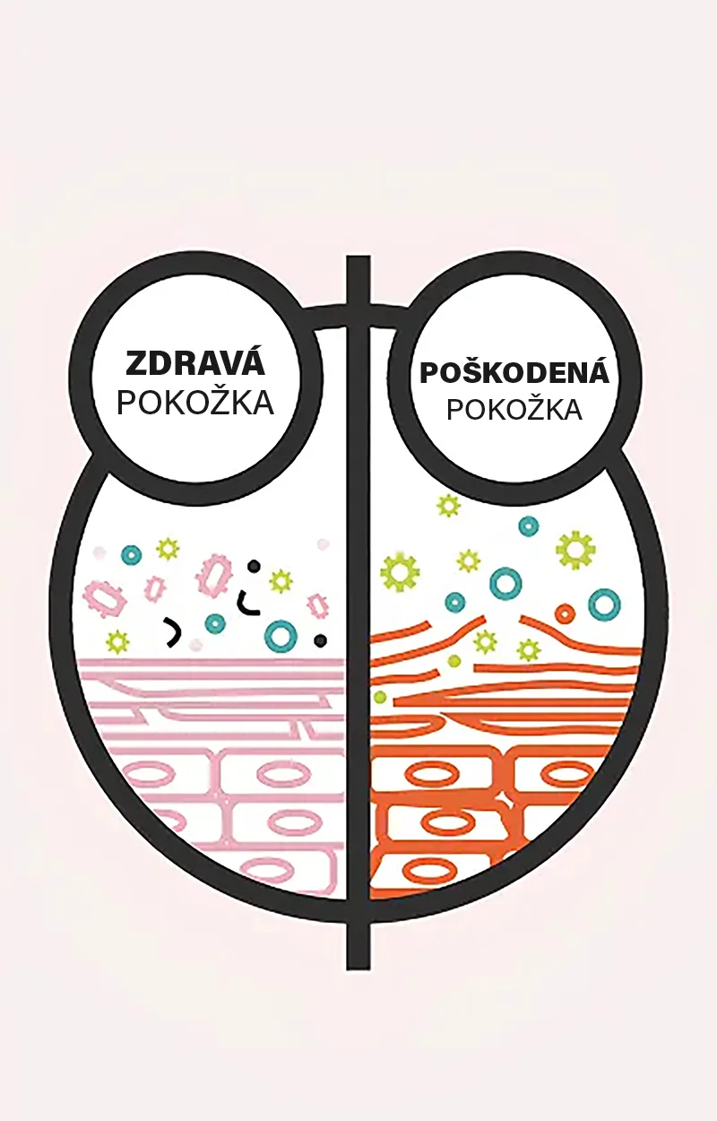 Ilustracja pokazująca różnicę między zdrową a niezdrową skórą.